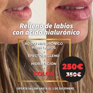 RELLENO DE LABIOS