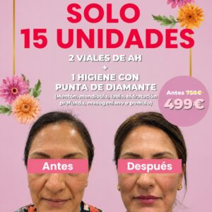 ✨ FULL FACE: RENUEVA TU PIEL POR COMPLETO ✨