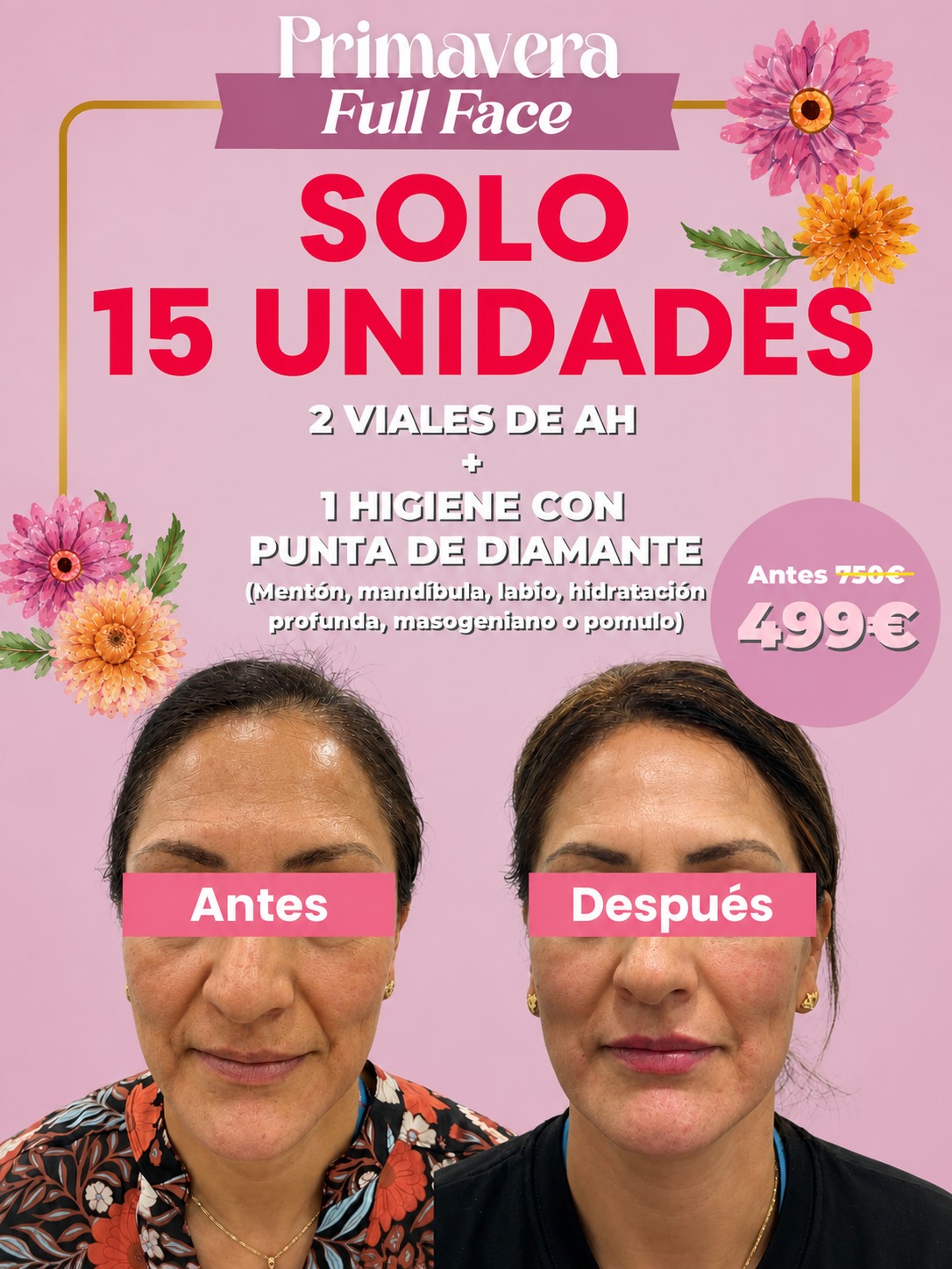limpieza-facial-premium-navidad-bmc-biomedical-argüelles-madrid-centro-clinica-estetica-belleza