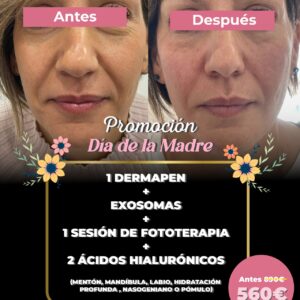 ✨ FULL FACE: RENUEVA TU PIEL POR COMPLETO ✨