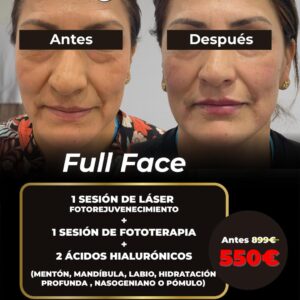 ✨ FULL FACE: RENUEVA TU PIEL POR COMPLETO ✨