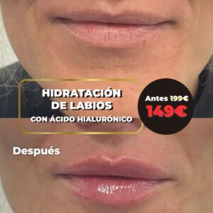 HIDRATACIÓN DE LABIOS