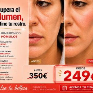 ÁCIDO HIALURÓNICO PARA PÓMULOS